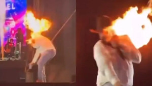 Sertanejo se acidenta e queima rosto durante show